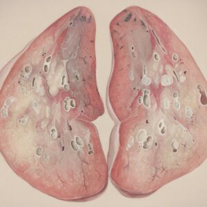 Photo Lung tissue