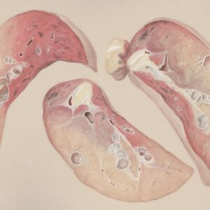 Photo Lung tissue
