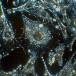 Photo Cancer cells