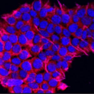 Photo Cancer cells