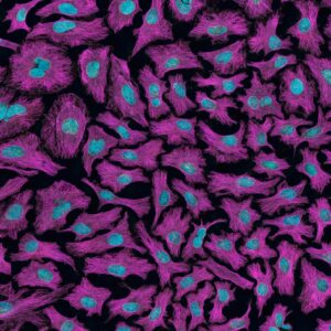 Photo Cancer cells