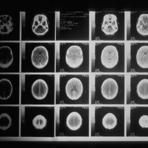Photo Brain scan