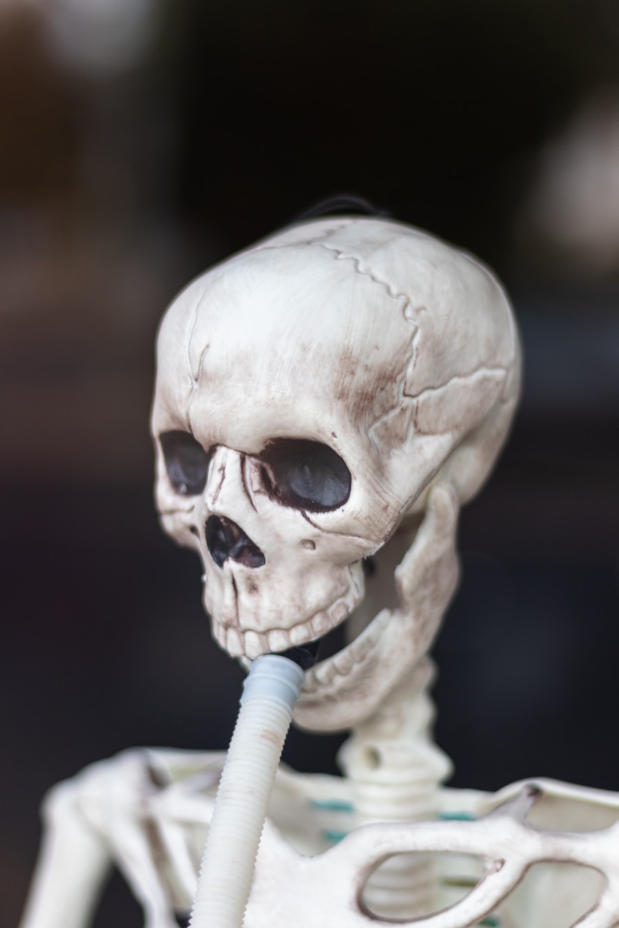 Is Mesothelioma 100% Fatal?