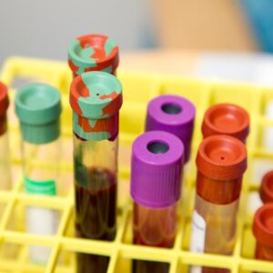 Photo "Does Mesothelioma Show Up in Blood Work?"
