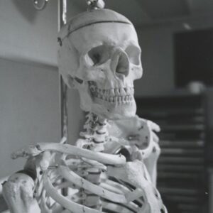 Photo "Does Mesothelioma Show Up on Xray?"